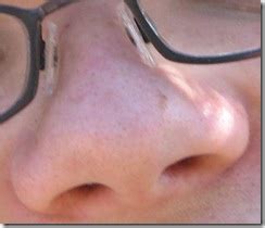 Namun, setelah memeriksakan diri ke rumah. Perbedaan Fungsi Lubang Hidung Kanan dan Kiri