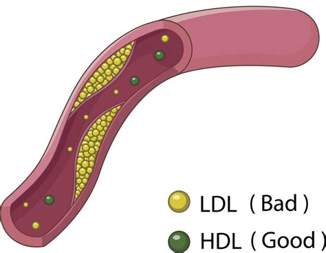 High Hdl Levels Recommendations Balance And Tips