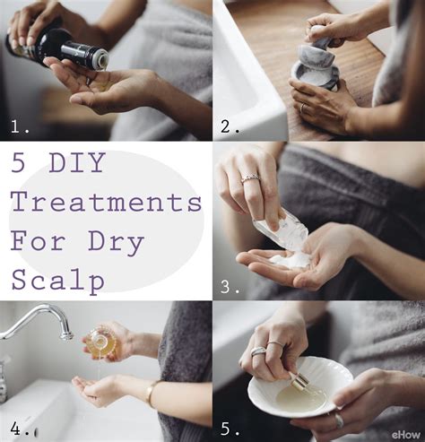 The Best 5 Diy Treatments For A Dry Scalp Dry Scalp Dry Itchy Scalp