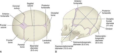 Fetal Skull