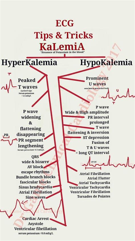 Dr Fi On Twitter Ecg Tipsandtricks Hyperkalemia Vs Hypokalemia