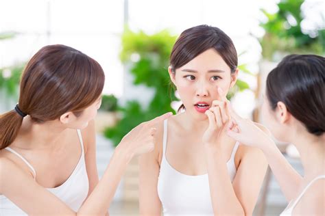 Surgical and nonsurgical procedures are performed to remove acne is acne scar treatment painful? Don't Let Acne Define Your Quality Of Life | Dermatix ...