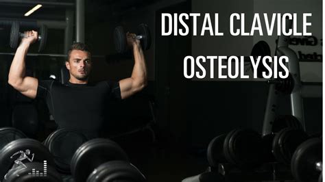 Distal Clavicle Osteolysis A Common Shoulder Injury For Weightlifters