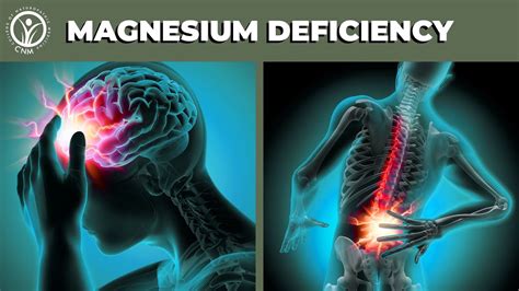 8 warning signs magnesium deficiency cnm youtube