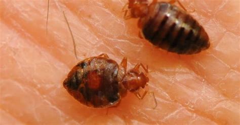 Can you get sick from bed bug bites? http://www.varmentguard.com/bed