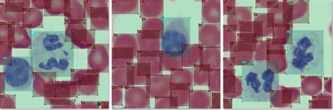Blood Cell Detection Dataset