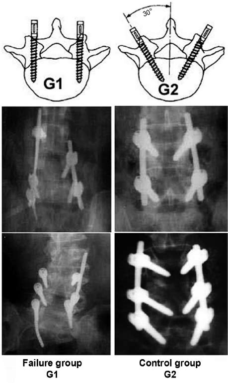 Plain Radiography Of The Lumbosacral Spine And Diagrammatic