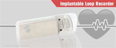 Implantable Loop Recorder Uses Procedures Precautions Advantages