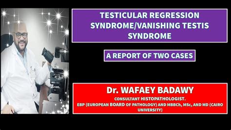Testicular Regression Syndromevanishing Testis Syndrome By Dr Wafaey