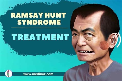 Ramsay Hunt Syndrome Treatment Medinaz Blog