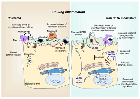 Ijms Free Full Text Dysfunctional Inflammation In Cystic Fibrosis