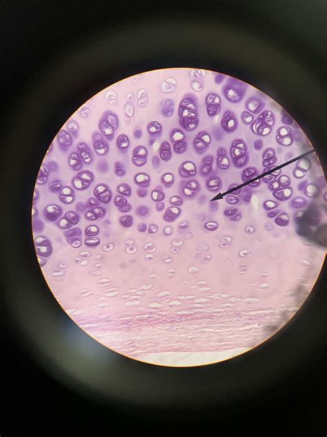 Hyaline Cartilage Microscope Image Body Tissues Hyaline Cartilage