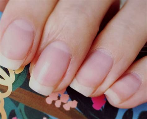 things your nails can tell you about your health herzindagi