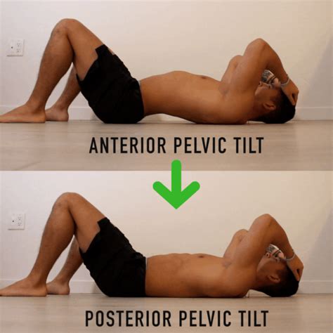 Fix Anterior Pelvic Tilt In 10 Minutes Per Day With This Corrective Routine