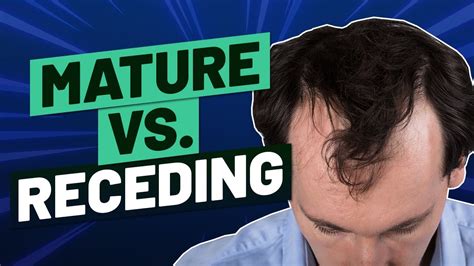 Mature Hairline Vs Receding Hairline How To Tell The Difference Hot Sex Picture
