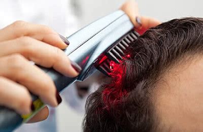 These are some of the best products for a. Best Hair Regrowth for Receding Hairline