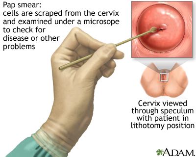 If your pap smear is normal but your hpv test is positive, your doctor will talk to you about possible recommendations. Pap test | UF Health, University of Florida Health