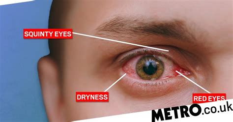 Images Reveal How Our Eyes Could Look If We Dont Cut Down On Screen