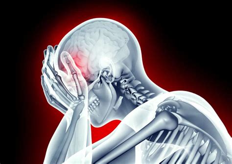 Treatment Of Visual Issues In Mild Traumatic Brain Injury Mtbi