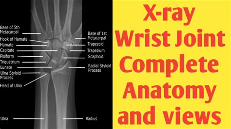 Wrist Anatomy Xray Anatomy Drawing Diagram