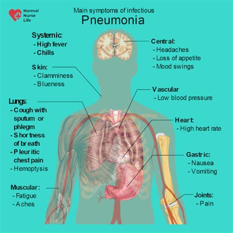 Nursing Care Plan For Pneumonia With 11 Great Tips To Use