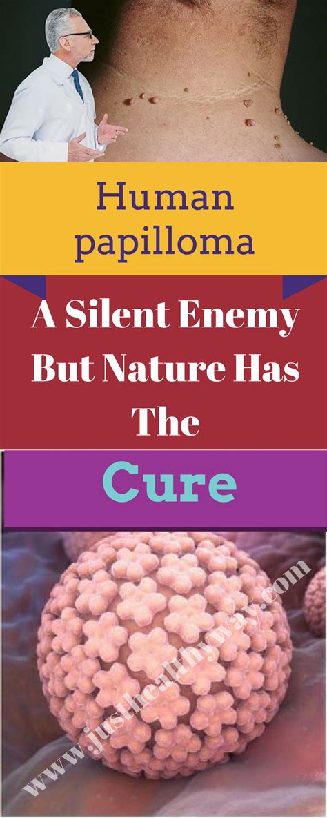 Human Papilloma A Silent Enemy But Nature Has The Cure The Cure