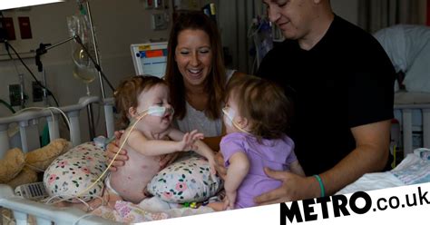 One Year Old Conjoined Twins Successfully Separated In 11 Hour Surgery