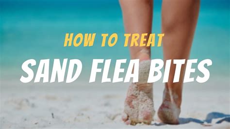 How To Treat Sand Flea Bites The Guardians Choice Youtube