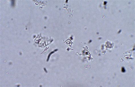 Giardia Lamblia Trophozoite Parasitology