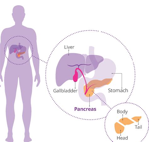 Why We Focus On Early Diagnosis Pancreatic Cancer Awareness