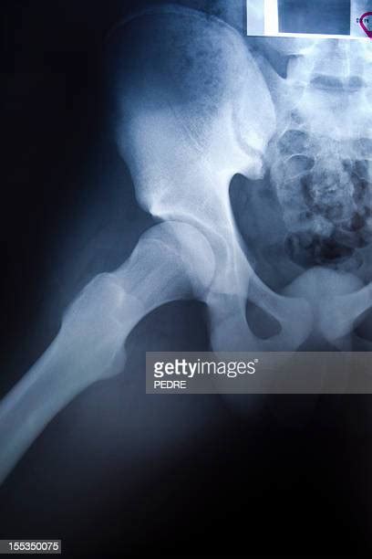 Groin Pain Male Photos And Premium High Res Pictures Getty Images