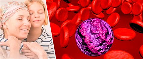 Breve descrizione dei principali tipi di leucemia: Leucemia Mieloide Aguda, una de las enfermedades más ...