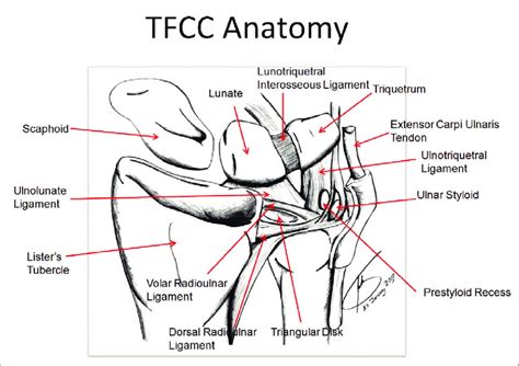 Tfcc Anatomy 18 The Tfcc Consists Of The Triangular Fibrocartilage
