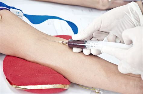 Blood Tests For Allergies Allergies And Health