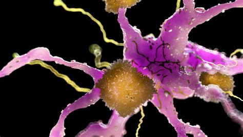 The fda on monday approved aducanumab from biogen (nasdaq:biib) and its however, the fda granted aduhelm an accelerated approval based on its ability to improve amyloid protein. Aducanumab BLA for Alzheimer Disease Submitted for FDA Review - MPR