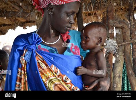 In This Photo Taken Sunday Dec 10 2017 Elizabeth Nyakoda Holds Her Severely Malnourished 10