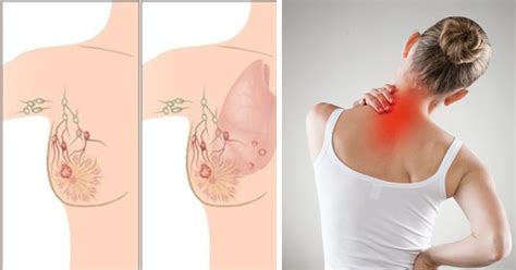 Your body is a highly complex, interconnected system. 5 Warning Signs of Breast Cancer That Many Women Ignore ...