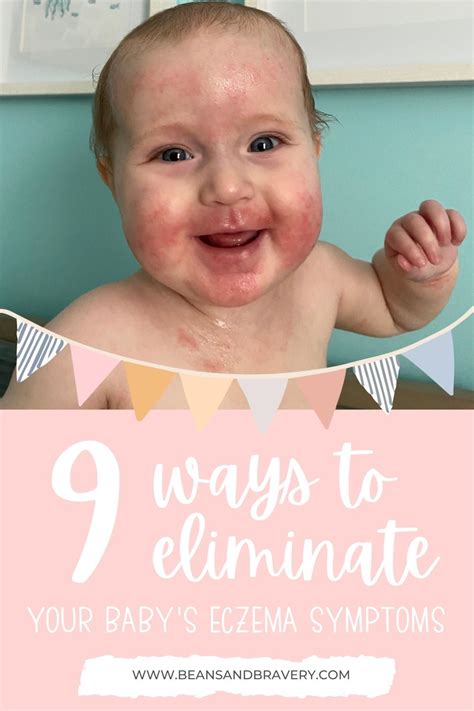 9 Ways To Alleviate Your Babys Eczema Symptoms Beans And Bravery