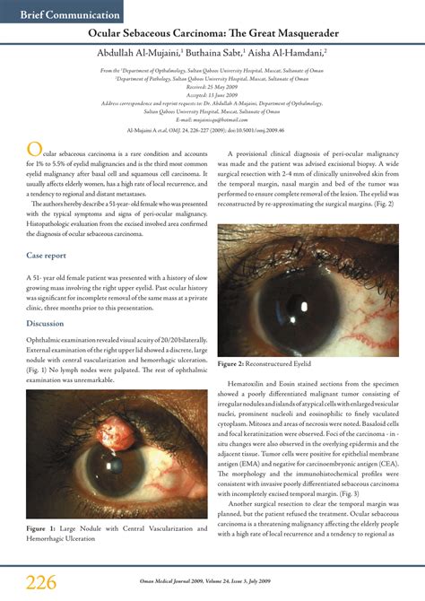 Pdf Ocular Sebaceous Carcinoma The Great Masquerader