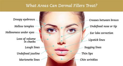 Dermal Fillers Injectables Fillers Botox Injection Sites