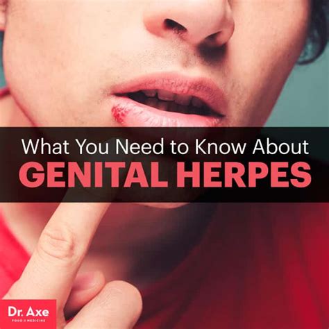 Do I Have Genital Herpes Johny Fit