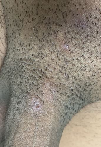 The proctor will announce during different sections how much time remains. Help, Need insight on what this could be!? | Genital ...