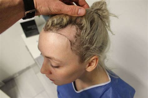 You should choose the one that fits your. The horrible effects a ballerina bun has on your hair ...