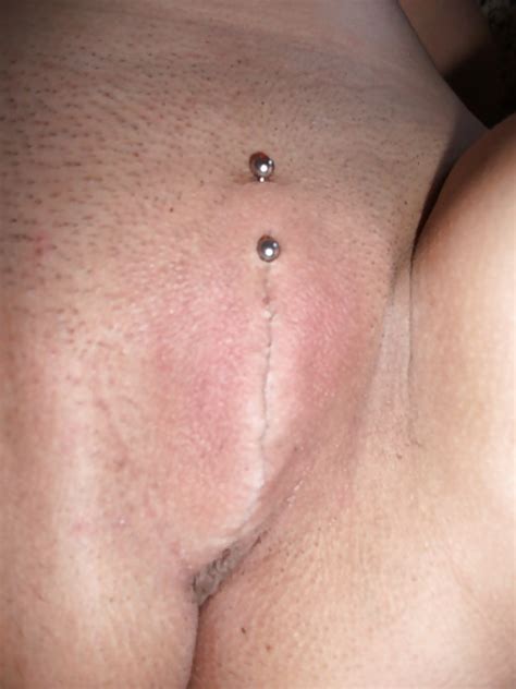 Body Modification Genital Beading Photos Xxx Porn