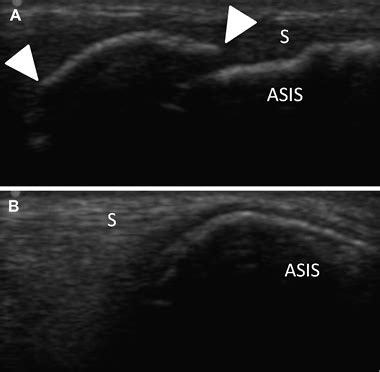 Journal of Rehabilitation Medicine - Anterior superior ...