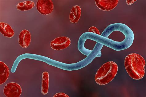 Ebola does not pose a significant risk to the u.s. Ebola: Sintomas, o que é, Cura, Prevenção, Tratamento e Mais
