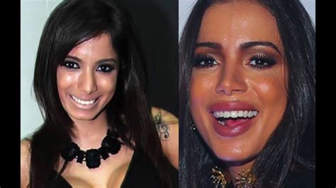 Annita Antes E Depois Jornal Britânico Compara Foto De Anitta Antes E