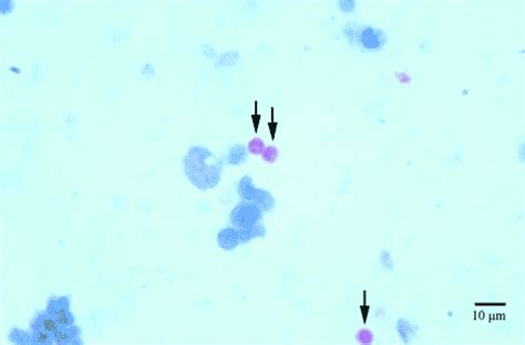 Signs that one is infected by a cryptosporidium parasite include the following the most common way to diagnose cryptosporidiosis is by analyzing a stool sample. Cryptosporidium Antibodies I Bio-Rad