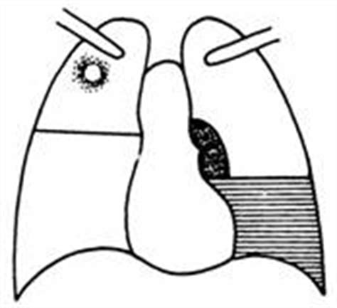 SEMIOLOGIA RADIOLOGICA A BOLILOR TORACELUI SI PLAMANULUI