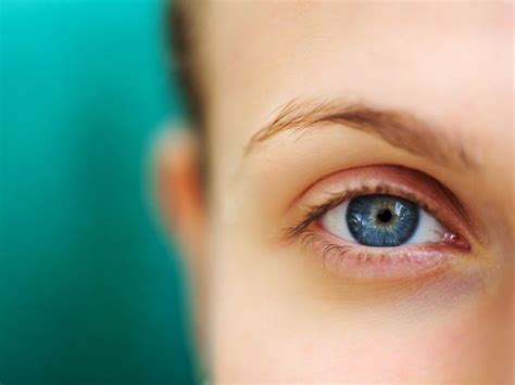 Ptosis Droopy Eyelid Causes Symptoms And Treatment